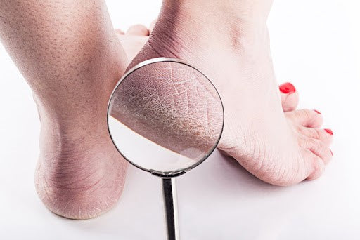 Mezclas milagrosas y otros tips para eliminar las durezas de los pies de los hombres y lucirlos saludables